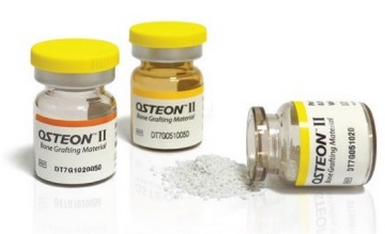 Osteon II для синус-лифтинга имплантата, 2,0 см/куб. 1 флакон